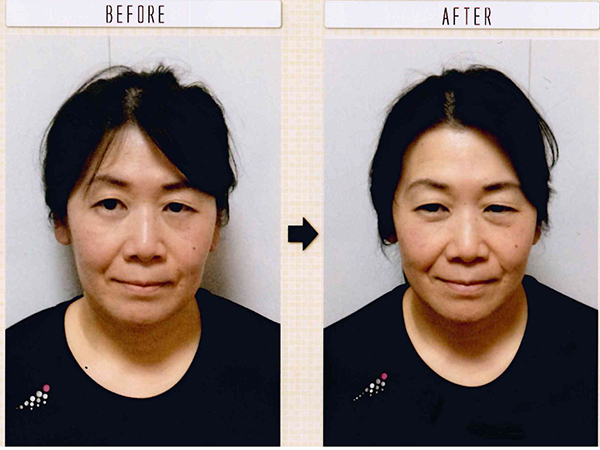 美容整形ストップ!